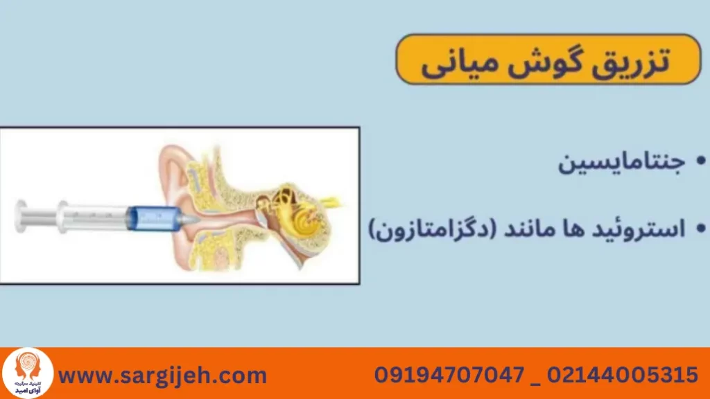 تزریق گوشی برای درمان منییر